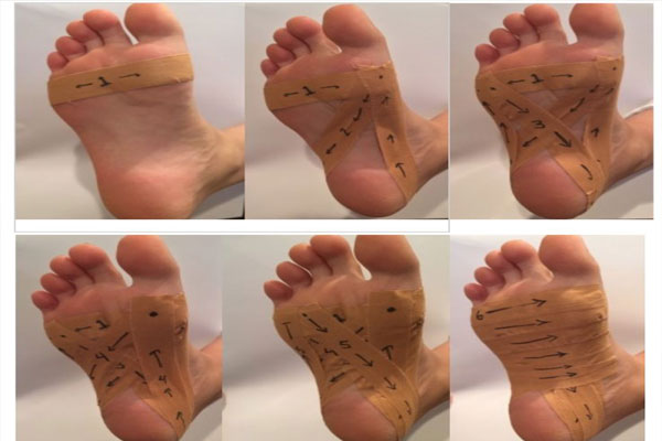 آموزش ماساژ کف پا در کاهش درد سیاتیک
