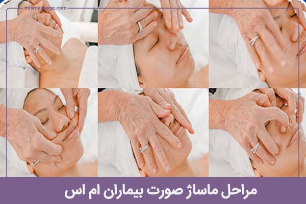 مراحل ماساژ صورت بیماران ام اس به چه صورت است؟