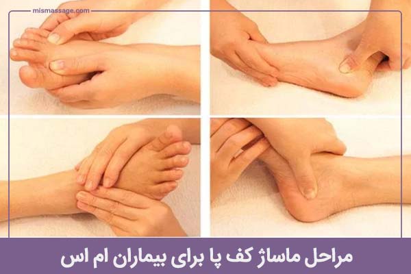 ماساژ کف پا برای بیماران ام اس به چه صورت است؟